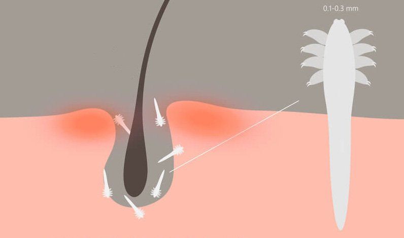 What Are Demodex Mites?